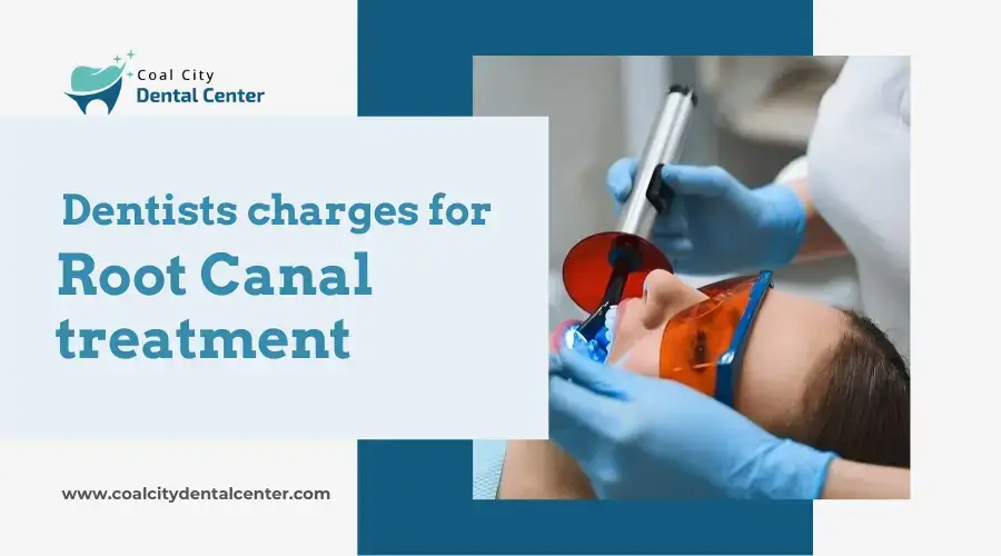 Read more about the article How much do dentists charge for a Root Canal treatment?